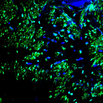 GFI1 Antibody