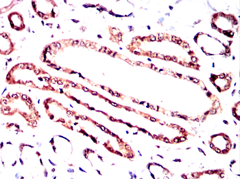 ERBB2 Antibody
