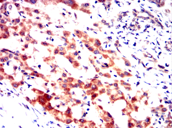 ERBB2 Antibody