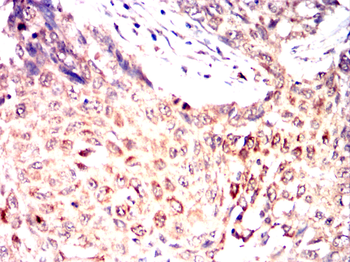 ERBB2 Antibody