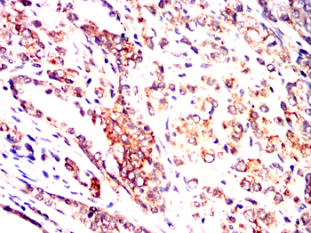 ERBB2 Antibody