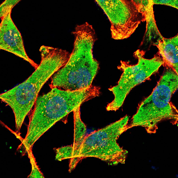 ITGA1 Antibody