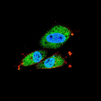 CSK Antibody