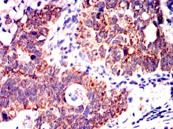CSK Antibody