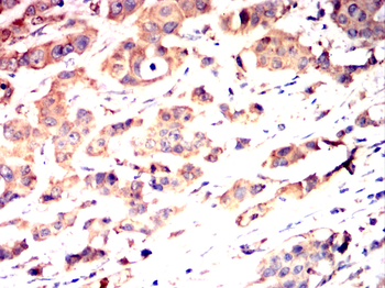 CSK Antibody
