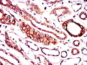 CSK Antibody