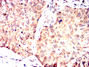 CSK Antibody