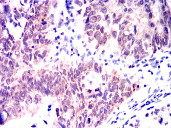 CRTC2 Antibody