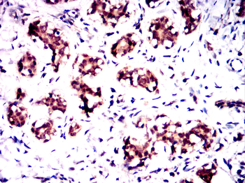 CRTC2 Antibody