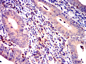 BLK Antibody