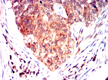 BLK Antibody