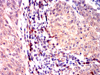 BLK Antibody