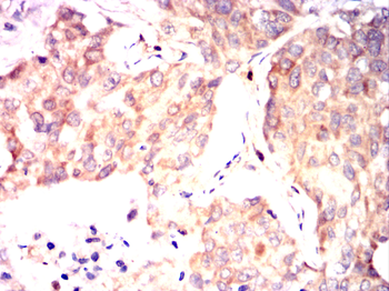 NACC1 Antibody
