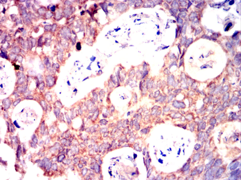 NACC1 Antibody
