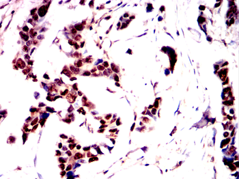 NACC1 Antibody