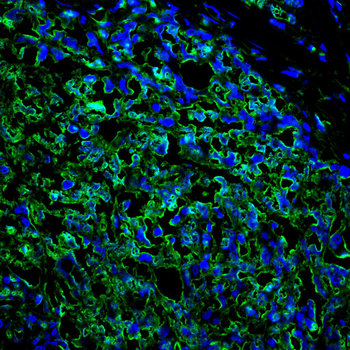 NACC1 Antibody