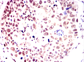 NACC1 Antibody