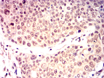 STK11 Antibody