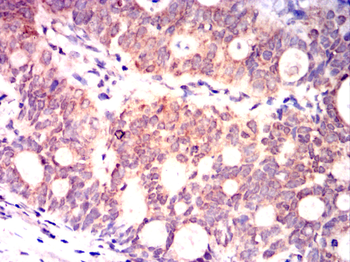 STK11 Antibody