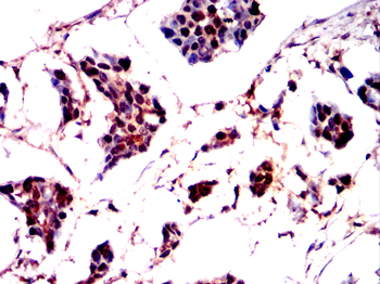 STK11 Antibody