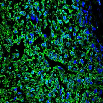 STK11 Antibody