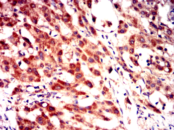 STK11 Antibody