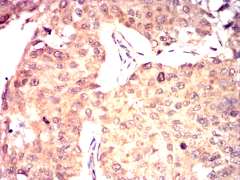 STK11 Antibody