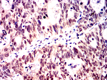 PSIP1 Antibody