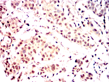 PSIP1 Antibody