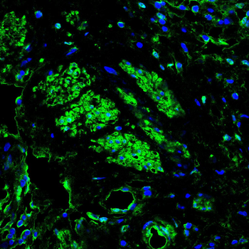 PSIP1 Antibody
