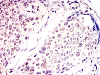 PSIP1 Antibody