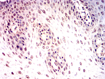 PSIP1 Antibody