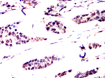 NR3C1 Antibody