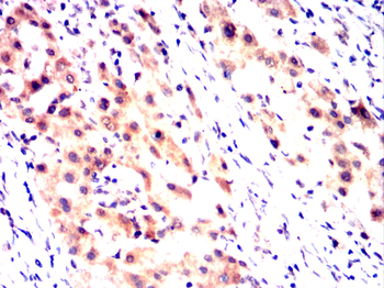 NR3C1 Antibody