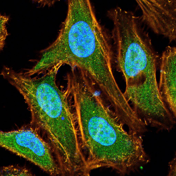 ATF2 Antibody