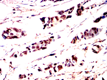 ATF2 Antibody