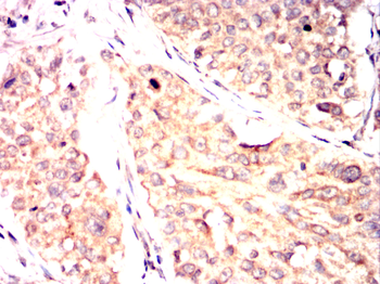 ATF2 Antibody