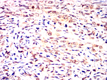 ATF2 Antibody