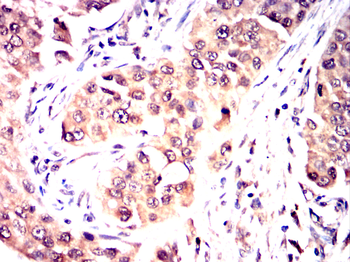 ATF2 Antibody