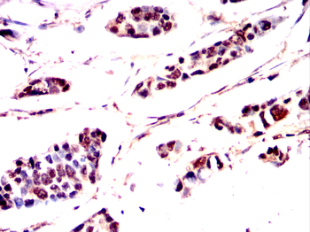MAP2K6 Antibody