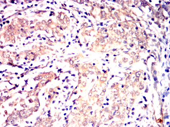 MAP2K6 Antibody