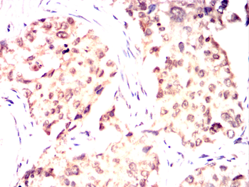 MAP2K6 Antibody