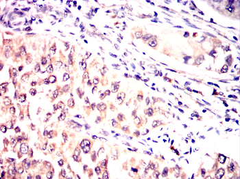 MAP2K6 Antibody