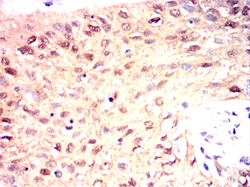 MAP2K4 Antibody