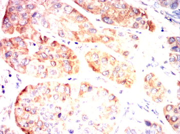 MAP2K4 Antibody