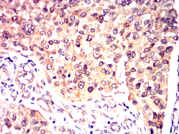 MAP2K4 Antibody