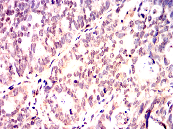 CRTC3 Antibody