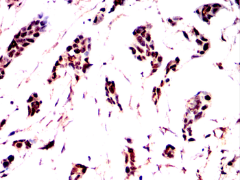 CRTC3 Antibody