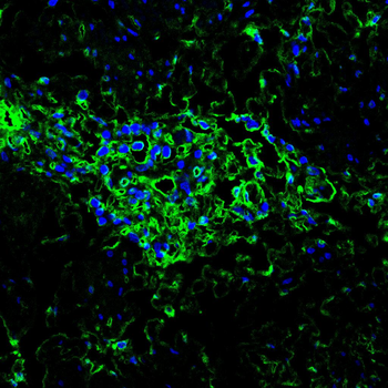 CRTC3 Antibody