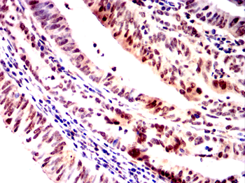 CRTC3 Antibody